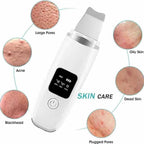 Facial Pore Cleaner with LED Display | Blackhead Remover