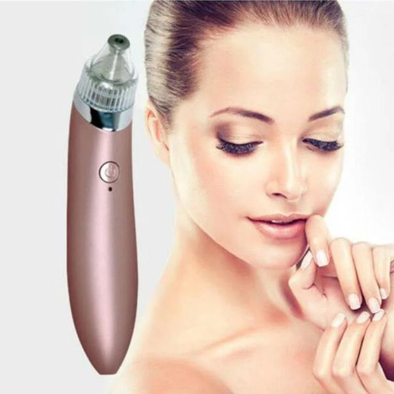 Acne Pore Vacuum Cleaner Blackhead Remover | USB Rechargeable Facial Pore Cleaner